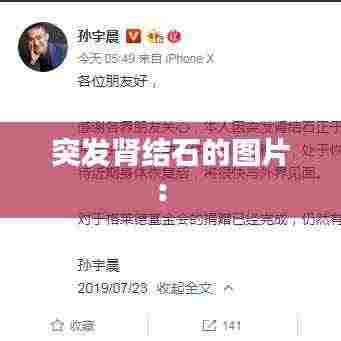 突发肾结石的图片： 