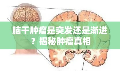 漫天飞舞 第2页